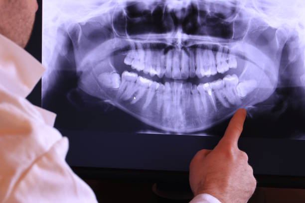 Best Emergency Tooth Extraction in North Windham, ME