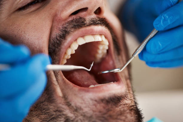 Best Urgent Care for Lost Fillings or Crowns in North Windham, ME